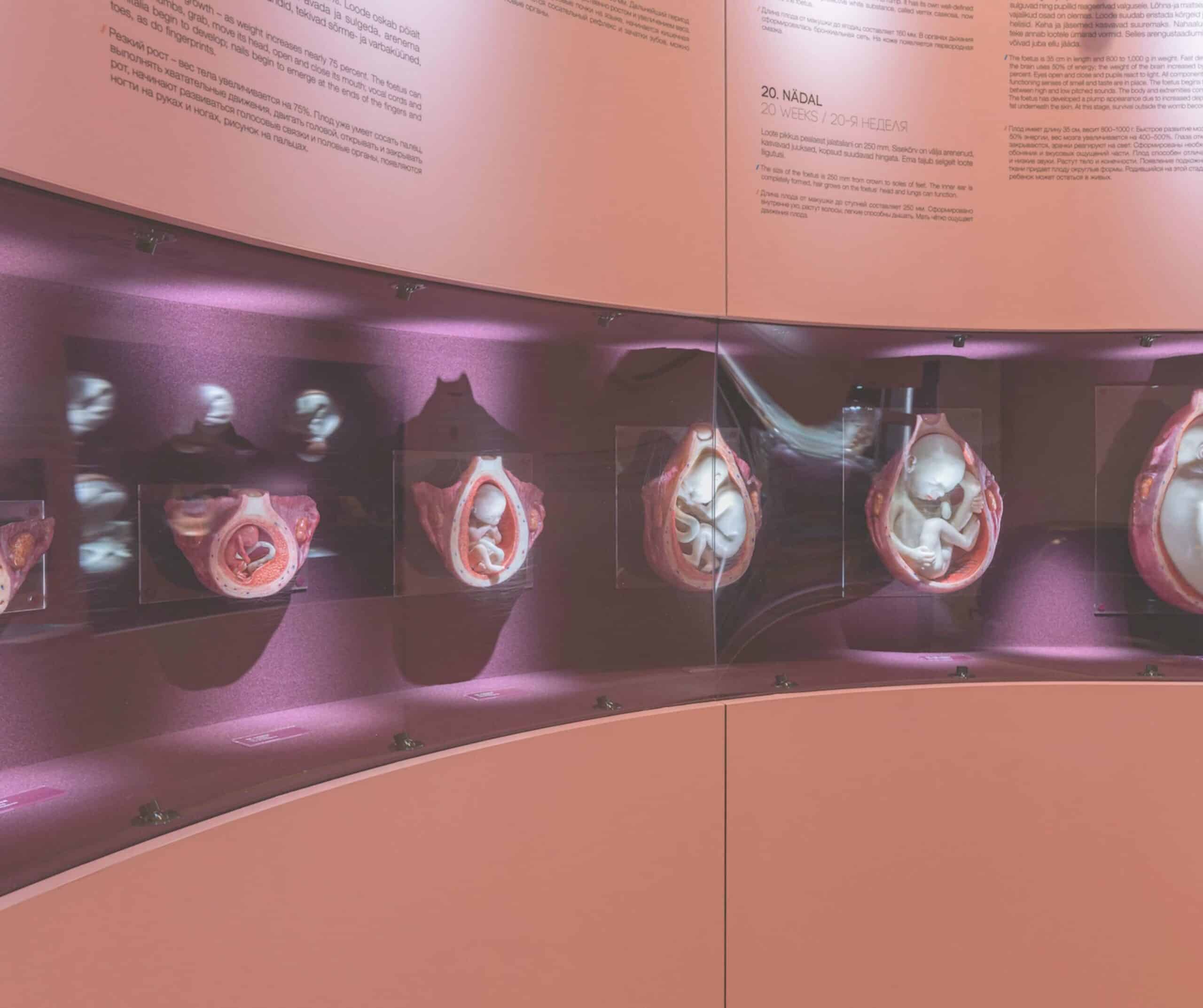 Estonian Health Museum